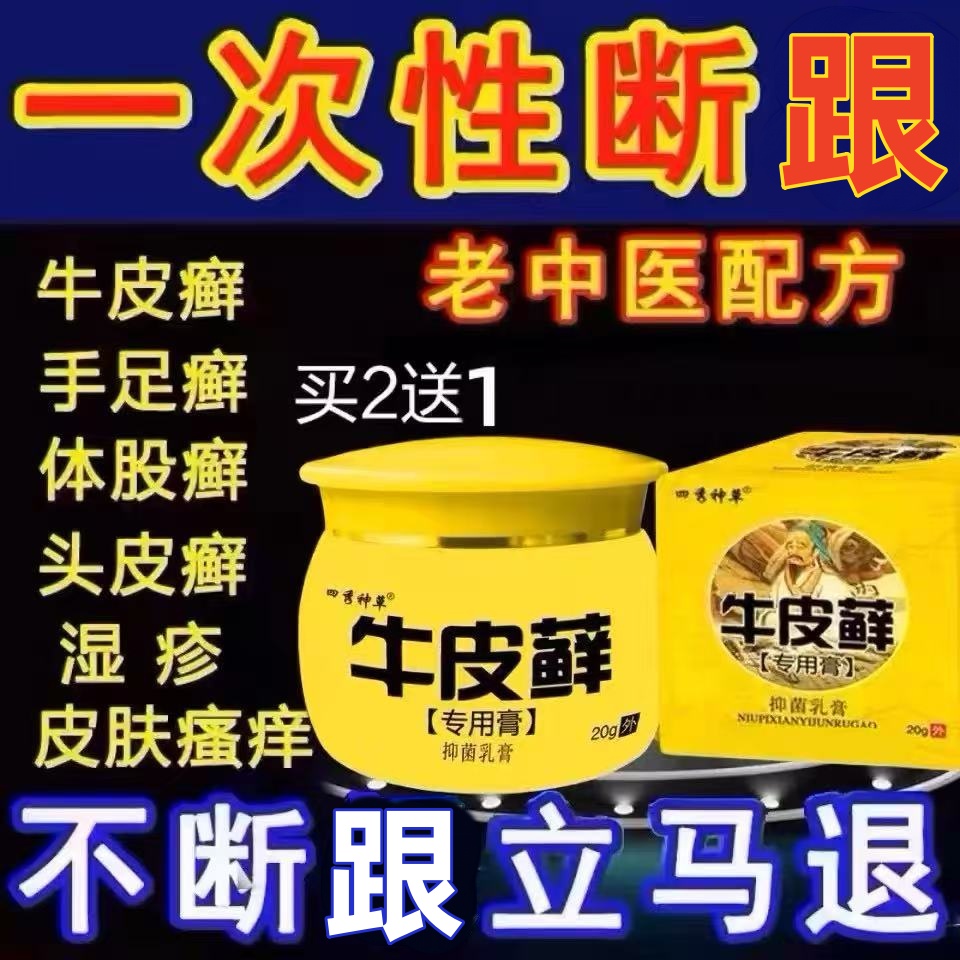 正品治牛皮银屑外用药癣股体廯头皮癣鲜藓专用膏痒银屑病皮肤杀菌