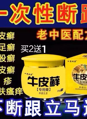 正品治牛皮银屑外用药癣股体廯头皮癣鲜藓专用膏痒银屑病皮肤杀菌