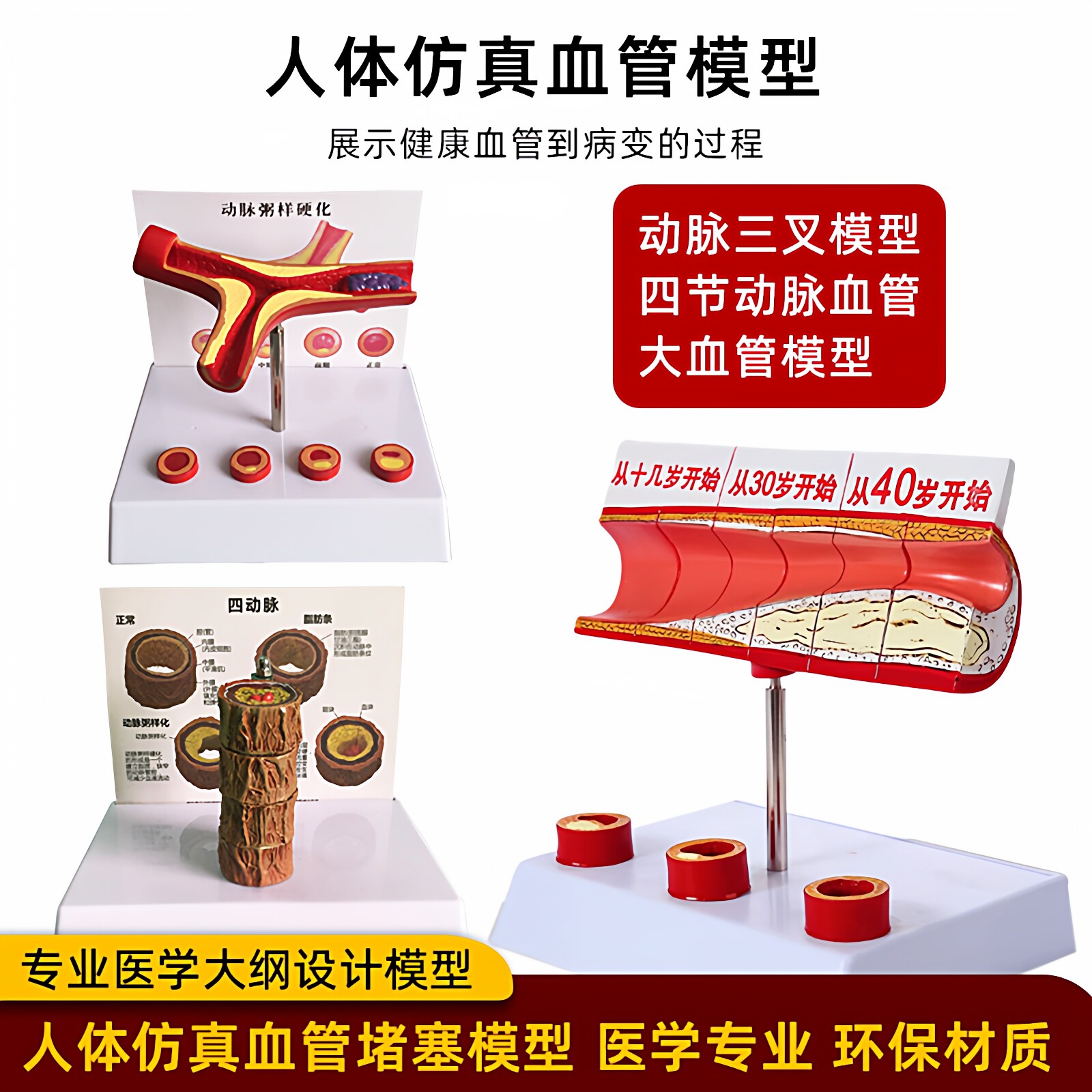 人体心血管层次结构解剖堵塞模型血栓脂肪病理动静脉放大硬化教具