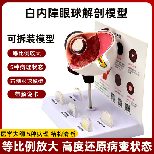 眼部白内障病理结构演示模型