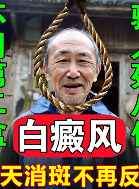 白癜风药膏快速消白斑专用特效补骨脂酊外用黑色素生长遮盖液神器