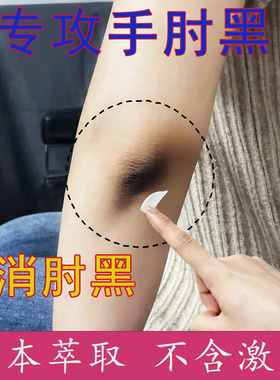 胳膊肘去黑药膏手指膝盖关节腋下黑色素沉淀去死皮磨砂膏变白神器