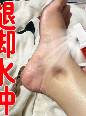 消肿去水肿专用老人脚肿消肿的药利尿排水肿小腿下肢浮肿特效喷剂