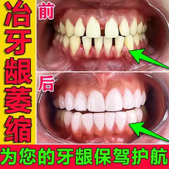 牙龈萎缩修复再生特效药治疗牙周炎牙齿松动暴露护龈固齿专用牙膏