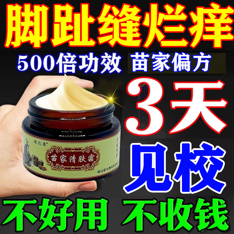 苗家偏方脚膏止痒气根去专用的药烂脚丫脱皮糜烂脚趾缝真菌感染膏