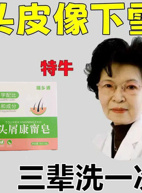 香港大药房毛炎宁毛囊焱洗发控油去油去屑止痒除螨虫皂全身可用