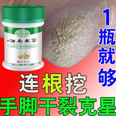手足裂口脚后跟干裂修复霜手足开裂防裂手脚跟开裂脱皮愈合皲裂膏