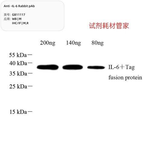 Anti-IL-6Rabbit pAb，抗IL-6兔pAb，IL-兔 polyclonal antibody