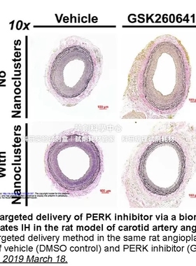 APExBIO PERK抑制剂 GSK2606414有效的和选择性的PERK抑制剂 科研