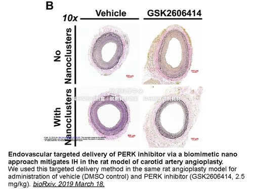 APExBIO PERK抑制剂 GSK2606414有效的和选择性的PERK抑制剂 科研
