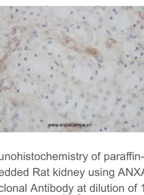 Elabscience®ANXA5多克隆抗体,E-AB-40117,应用于WB与IHC,200μL