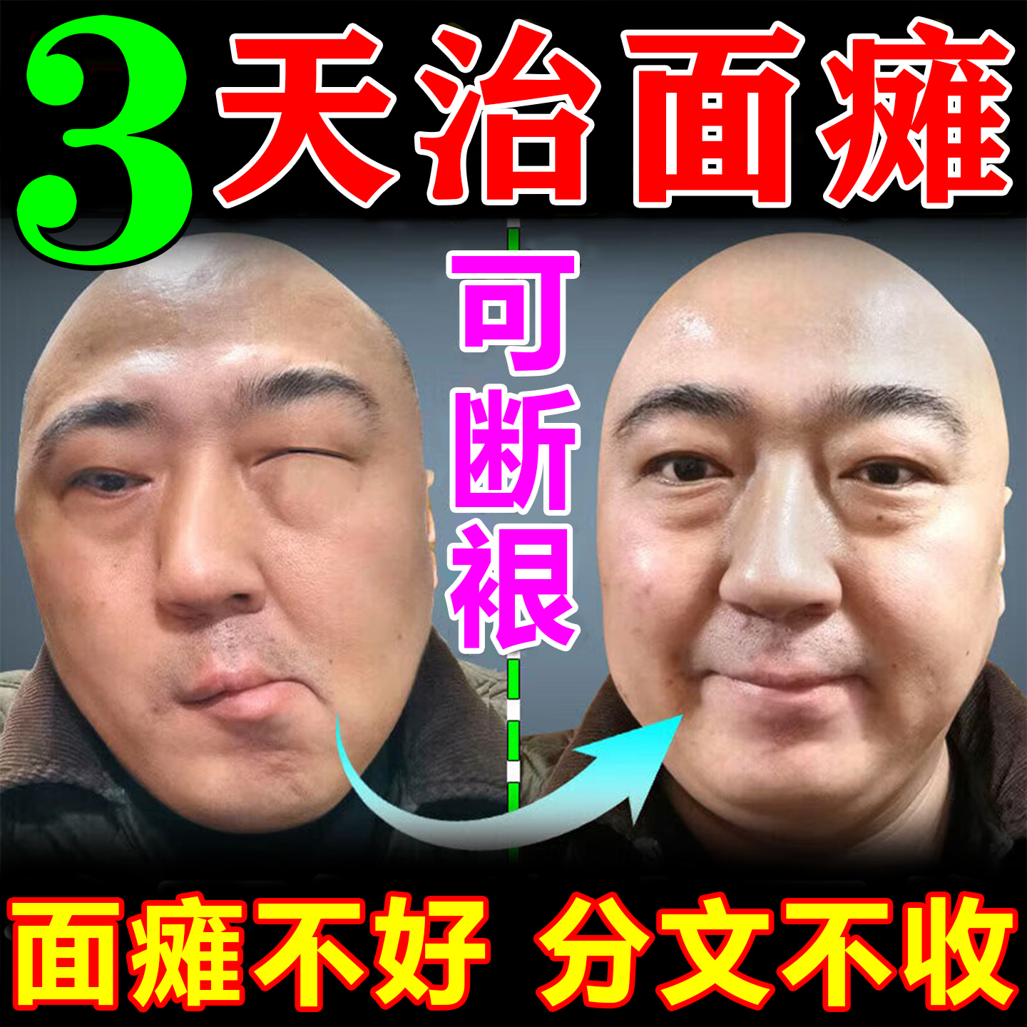 面瘫特效药膏贴僵硬麻木热敷神器脸部训练器口眼歪斜后遗症专用药