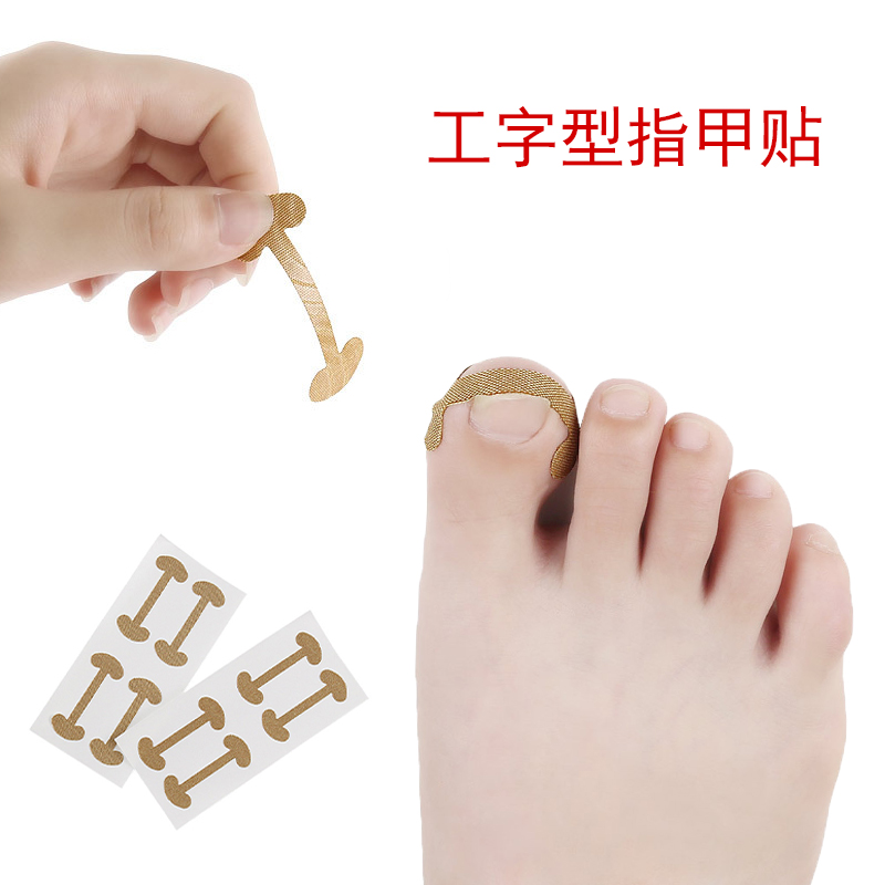 脚指甲甲沟嵌甲足甲矫正器拇指卷甲贴片变形长肉里贴快速修脚趾甲