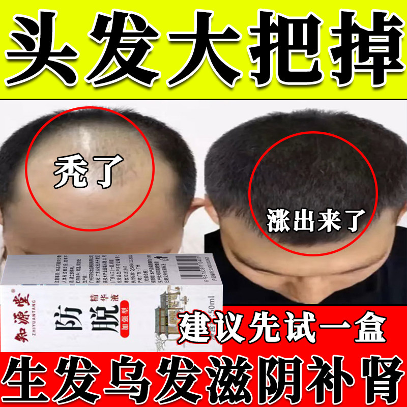 胱氨酸片 100 片云鹏辅助治疗产后脱发乏力生发肝炎防脱发