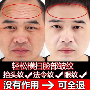祛除皱纹神器抬头纹去除男士提拉紧致六胜肽抗皱面霜抗衰老护肤品