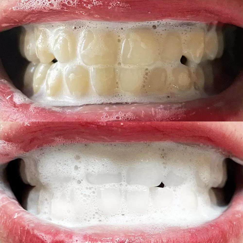 屈臣氏爆火~牙渍一擦即除~黑色烟渍~茶渍~去牙菌斑咖啡渍牙齿变白