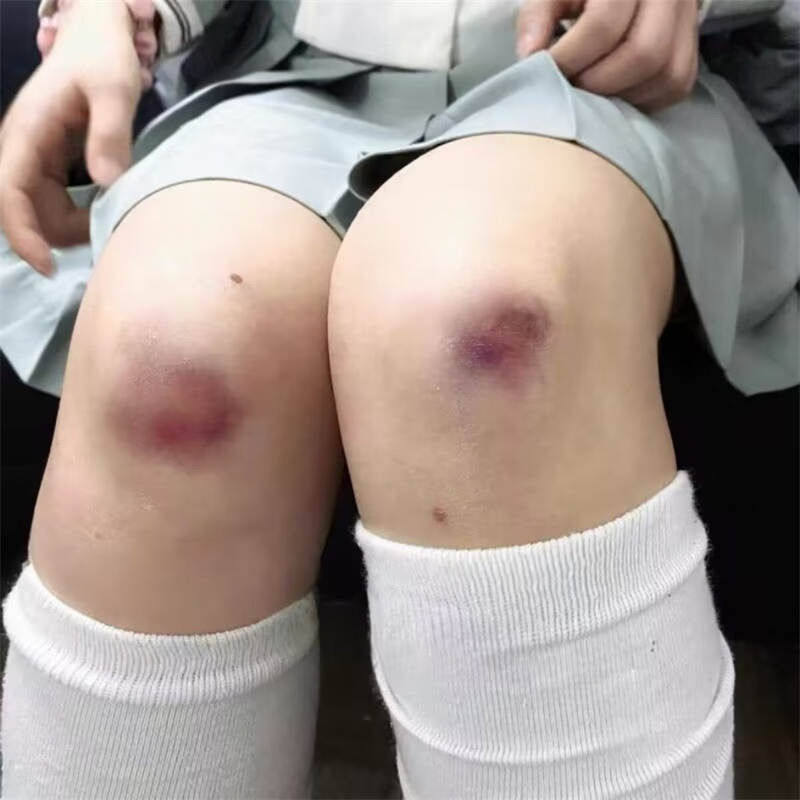 淤青伤病态美学伤疤纹身贴 万圣节派对妆容酒吧纹身逼真3D疤痕贴