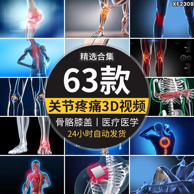 膝盖关节炎疼痛头颈腰椎3D疾病治疗人体骨骼解析医疗动画视频素材