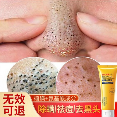 硫磺净颜控油洁面乳男女士深层清洁收缩毛孔补水保湿不紧绷洗面奶