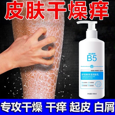 B5身体乳干痒全身皮肤干燥起皮痒秋冬季干性肤质补水保湿滋润肤露