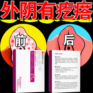 益舒柔壳聚糖妇科凝胶念珠菌阴道炎治疗细菌性外用宫颈糜烂的药