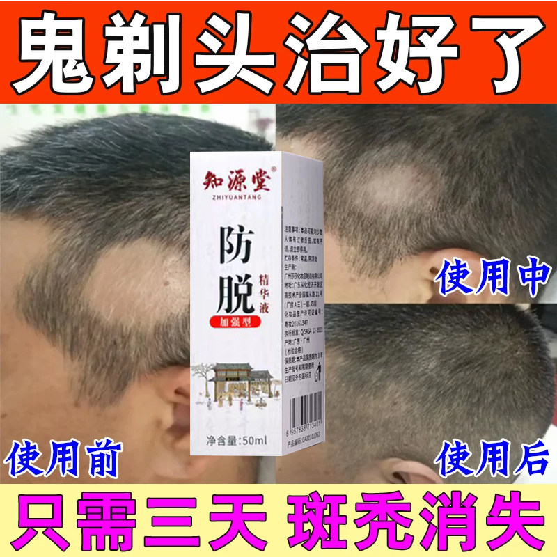 北京同仁堂乌发丸德众七宝美髯丸两虚益精血须发早白乌发黑发