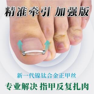 甲沟嵌甲矫正器钛合金弹片专用指甲炎脚趾往肉里长正甲贴日夜神器