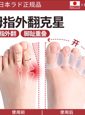 日本脚趾矫正器分趾器拇指外翻分趾矫正器男女士五指套脚趾分离器