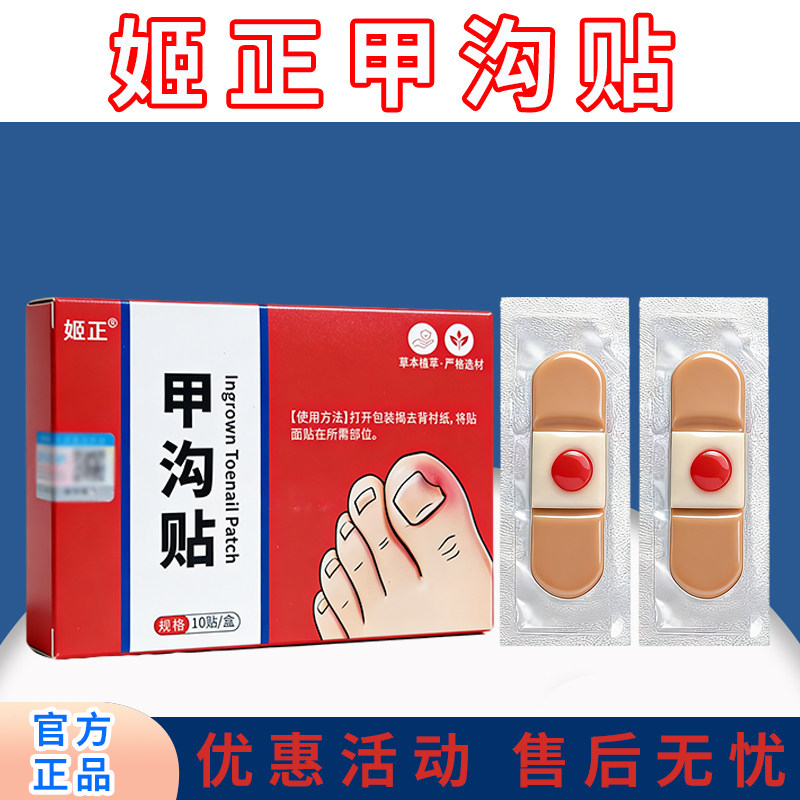 姬正甲沟贴矫正器正甲贴嵌甲脚指甲纠正器防趾甲长肉里专用隔离贴