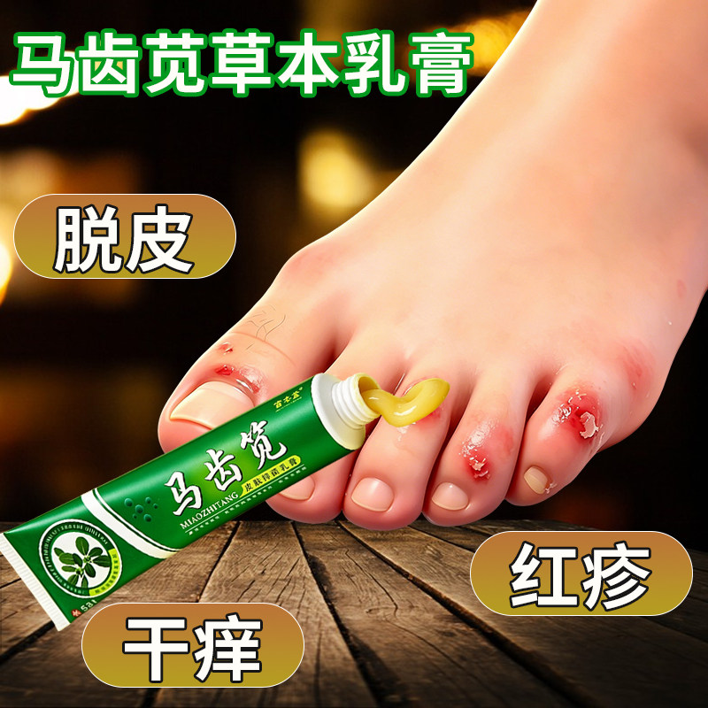 马齿苋草本乳膏15g皮肤外用脚底手部身体干痒脱皮红疹护理软膏