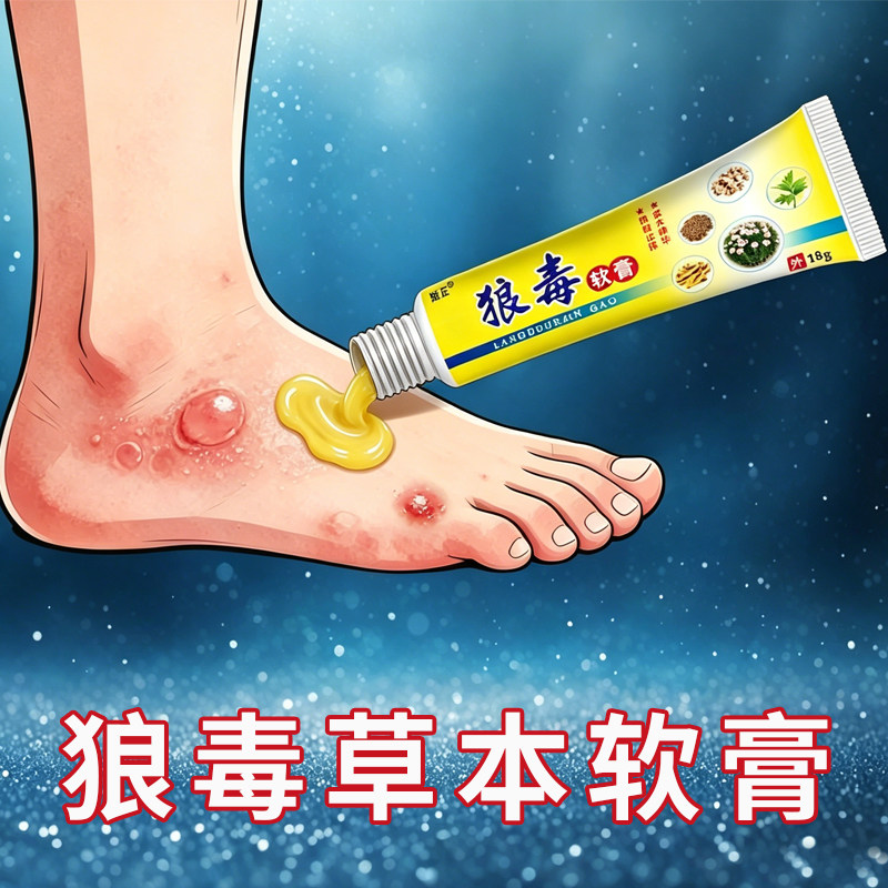 狼毒脚痒手部水泡脱皮烂脚丫脚臭除臭脚汗膏去痒乳膏