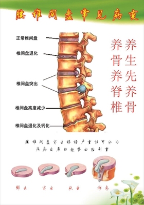 人体颈椎医学骨骼墙贴腰椎间盘常见病变挂图中医养生馆诊所装饰画