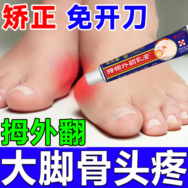 脚趾矫正器拇指外翻膏大拇指疼痛关节畸形拇囊炎专用膏