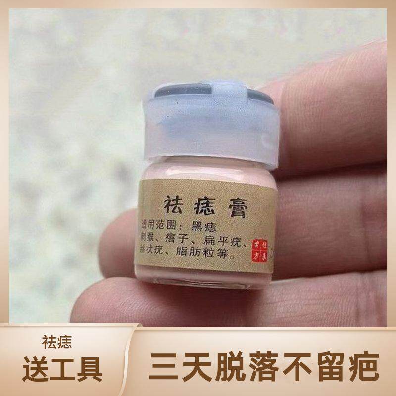 点痣药面部无痕去痣膏痣贴去痣去保健理疗
