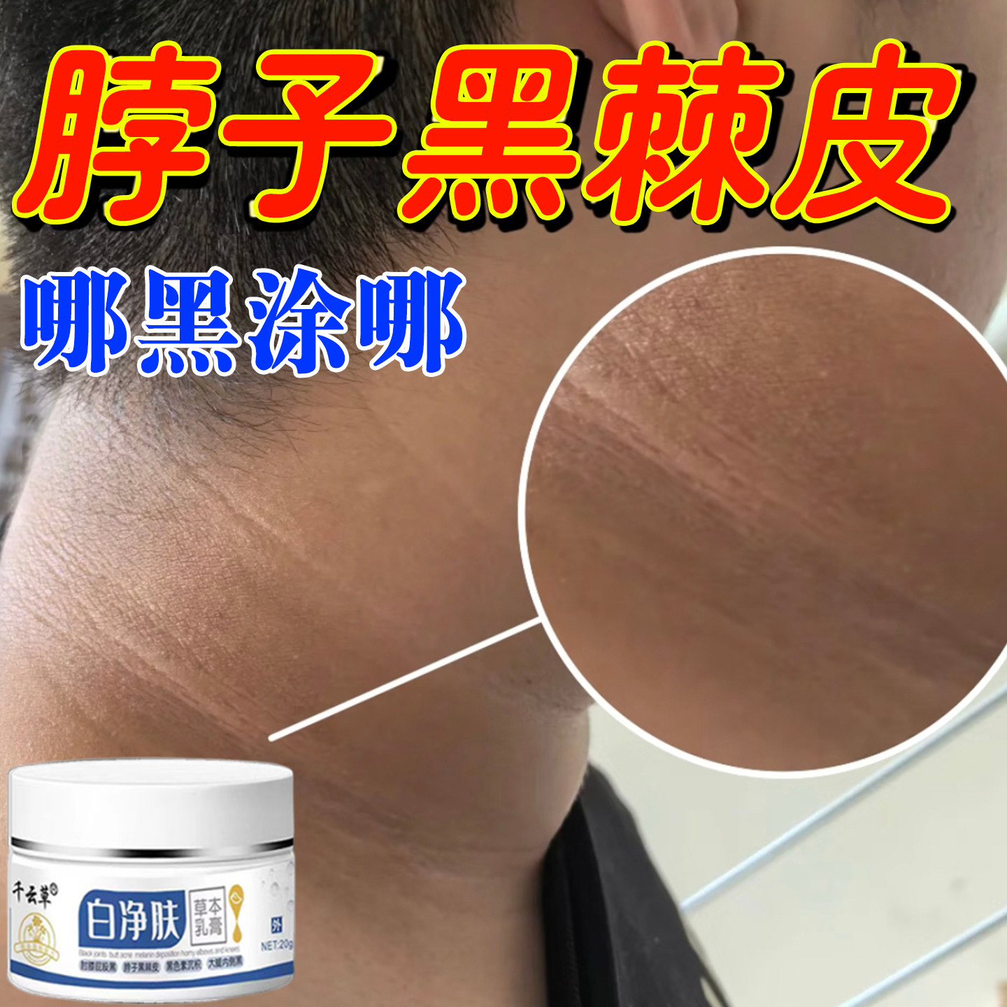 脖子黑黑的黑棘皮脖子黑色素沉淀洗不干净全身关节黑久坐屁股黑