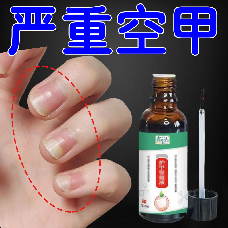 指甲变空心甲床甲肉分离修复受损游离线生长液指甲凹凸专用营养液