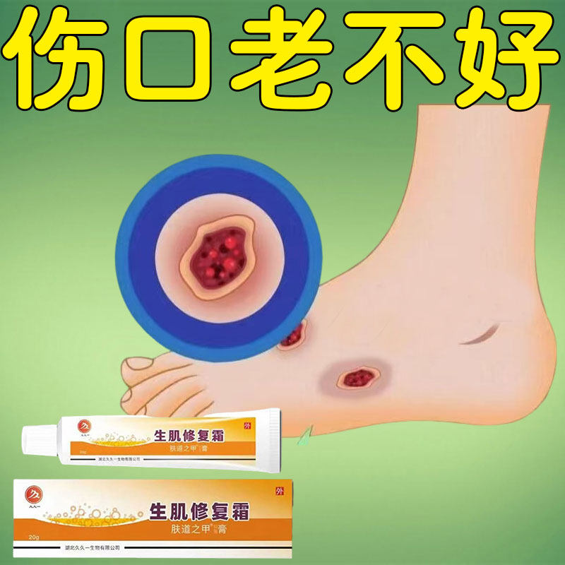 伤口愈合促进长肉生肌修复霜去腐抑菌生肌老烂腿烧伤烫伤快速结痂