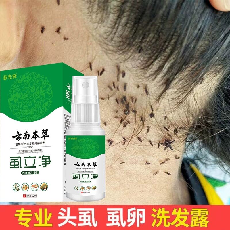 虱子药儿童小女孩去虱子药头发去虱立净去除阴虱虱卵一扫光百部酊