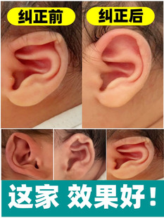 婴儿新生婴儿风耳垂耳夹耳贴片耳支撑耳塑形耳耳固定矫正器