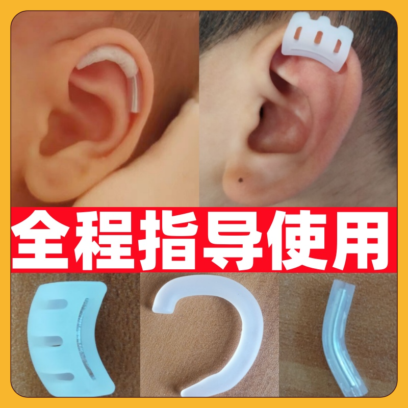 【效果很不錯】寶寶耳朵矯正器