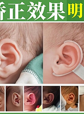 耳朵矫正器婴幼儿新生的儿宝宝耳廓耳撑耳夹招风耳耳形定型纠正贴