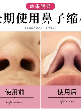 鼻翼缩小b神器防抠鼻子鼻梁保护贴固定鼻夹鼻部塑形隆鼻术后保护