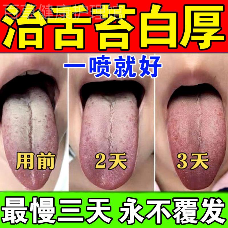 舌苔白厚口臭调理脾胃健祛湿气舌苔黄腻裂纹有齿痕口干去湿气喷剂