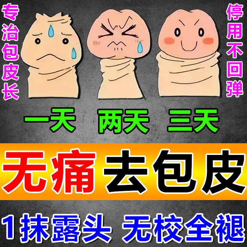 包皮过长环切除器自己割自动脱落包皮过长修复收缩矫正器男用隐形