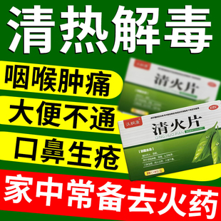 沃桐康清火片80片清热泻火通便咽喉肿痛牙痛头目眩晕