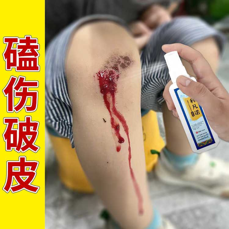 摔伤破皮膝盖磕伤专用喷剂伤口愈合喷雾擦伤皮肤外伤清理清创液