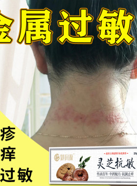 金属过敏皮肤瘙痒止痒膏外用花粉柳絮季节性皮肤过敏痒抗敏膏