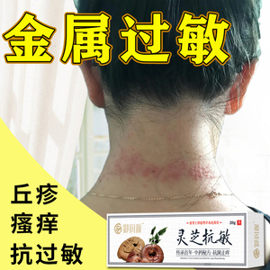 金属过敏皮肤瘙痒止痒膏外用花粉柳絮季节性皮肤过敏痒抗敏膏