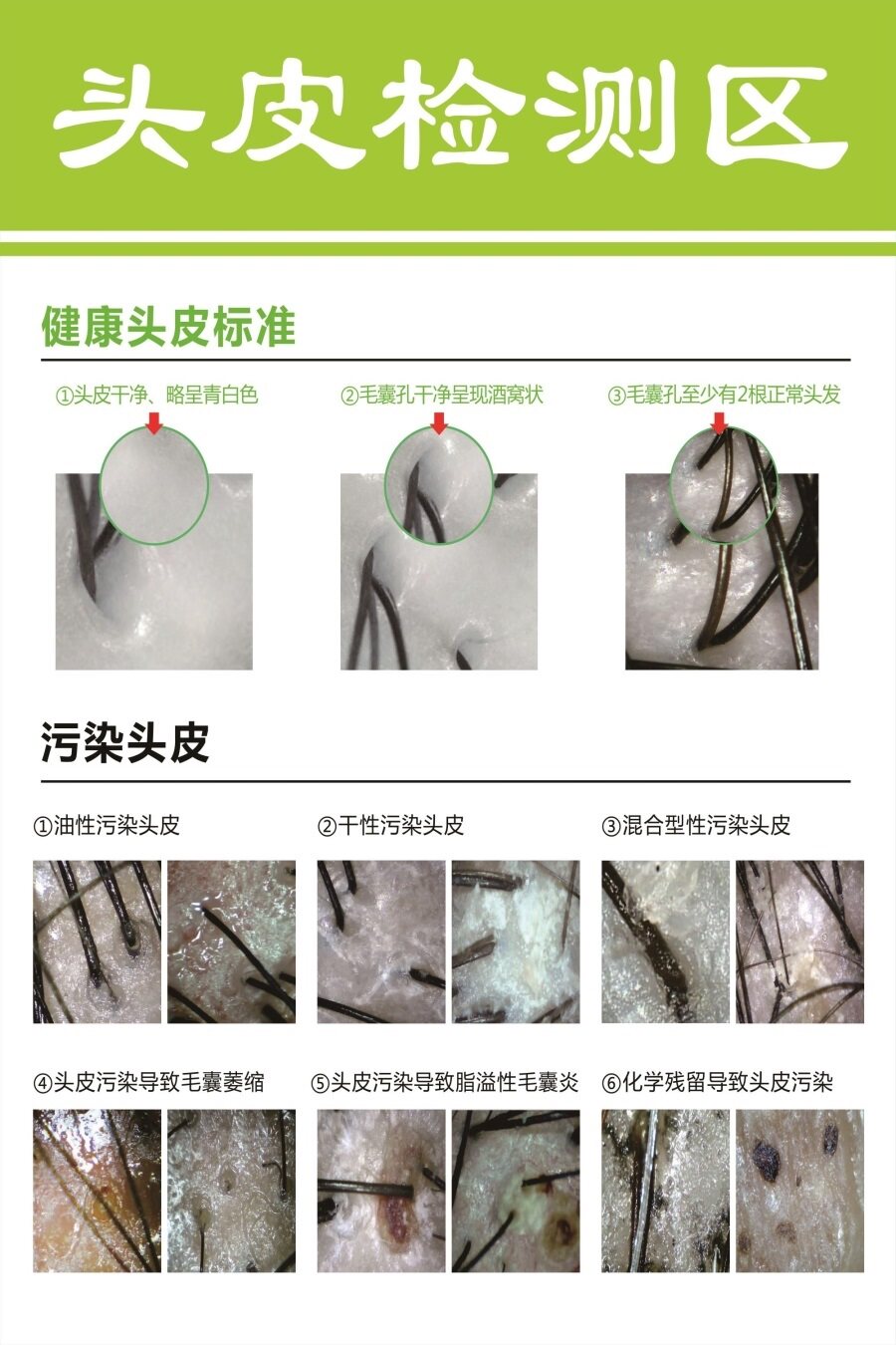 头皮保养海报植发生发挂图脱发养发头疗广告画头部理疗头皮检测区