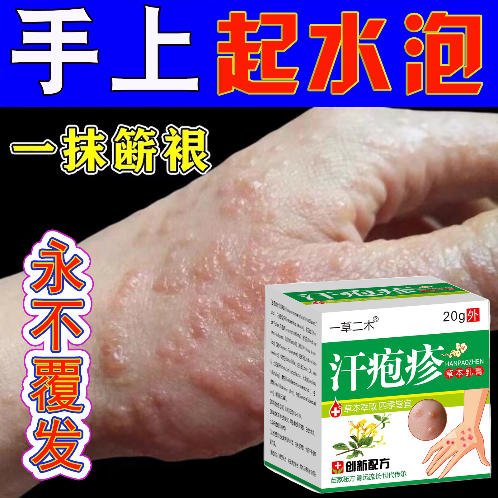 汗泡药膏汗状手上起小水泡止痒真菌感染手气膏干裂脱皮专用膏